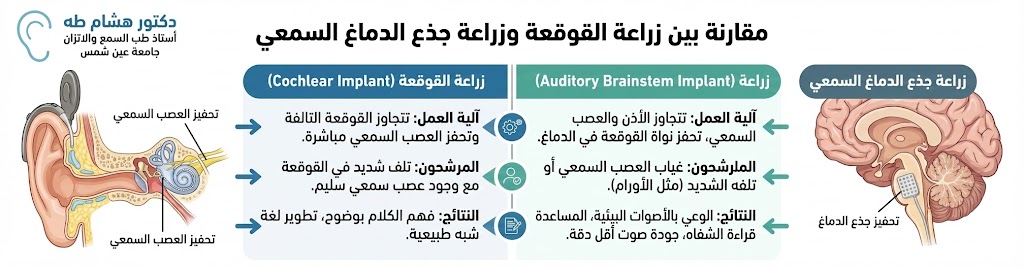 ما الفرق بين زراعة القوقعة وزراعة جذع الدماغ السمعي