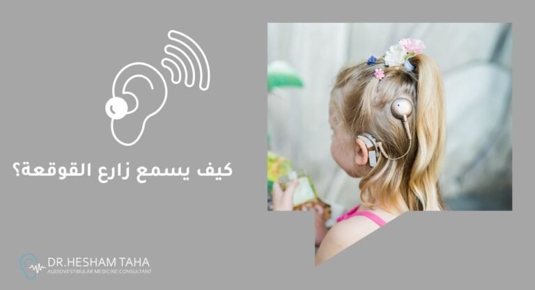 كيف يسمع زارع القوقعة