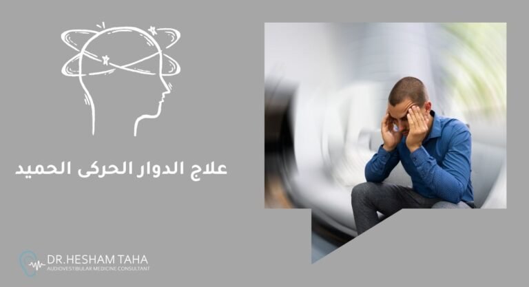 علاج الدوار الحركى الحميد